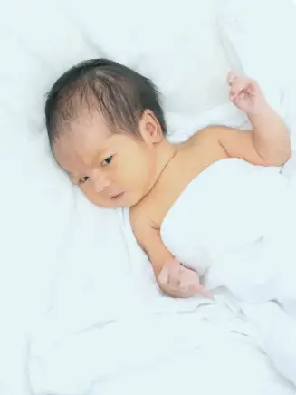 ewborn baby with visible yellow skin tone indicating mild jaundice, lying on a white blanket shortly after birth