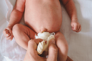 Umbilical Cord Care