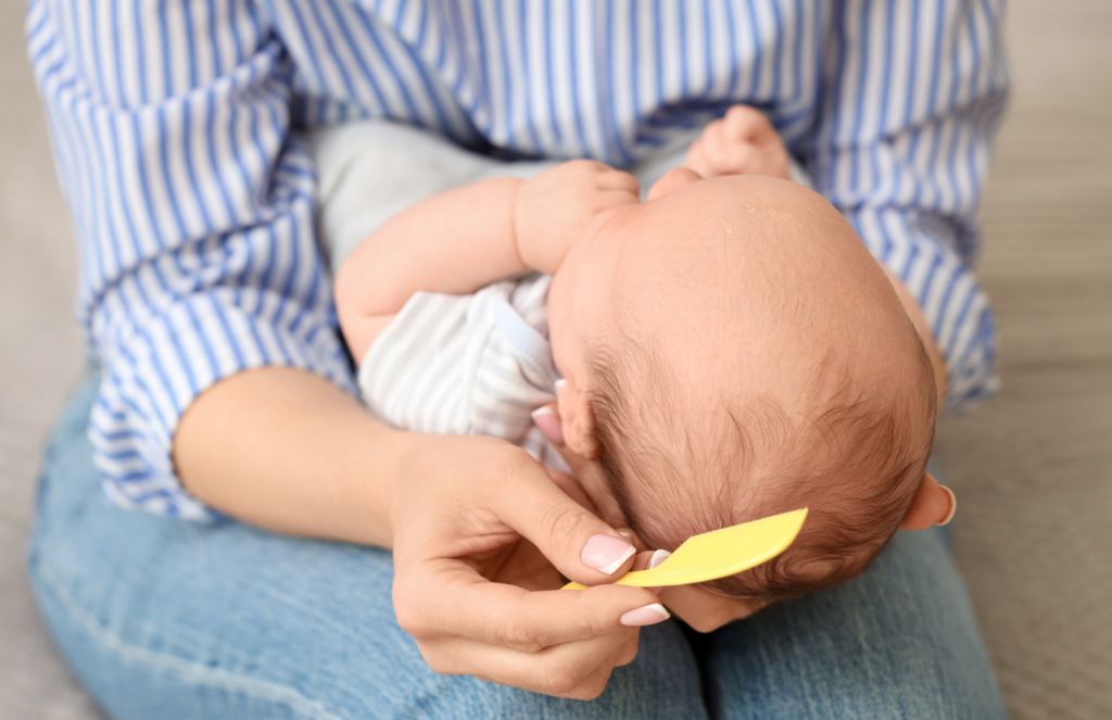 Parent gently tending to newborn's scalp to treat cradle cap flakes while holding baby in lap